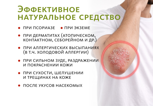 DVT 